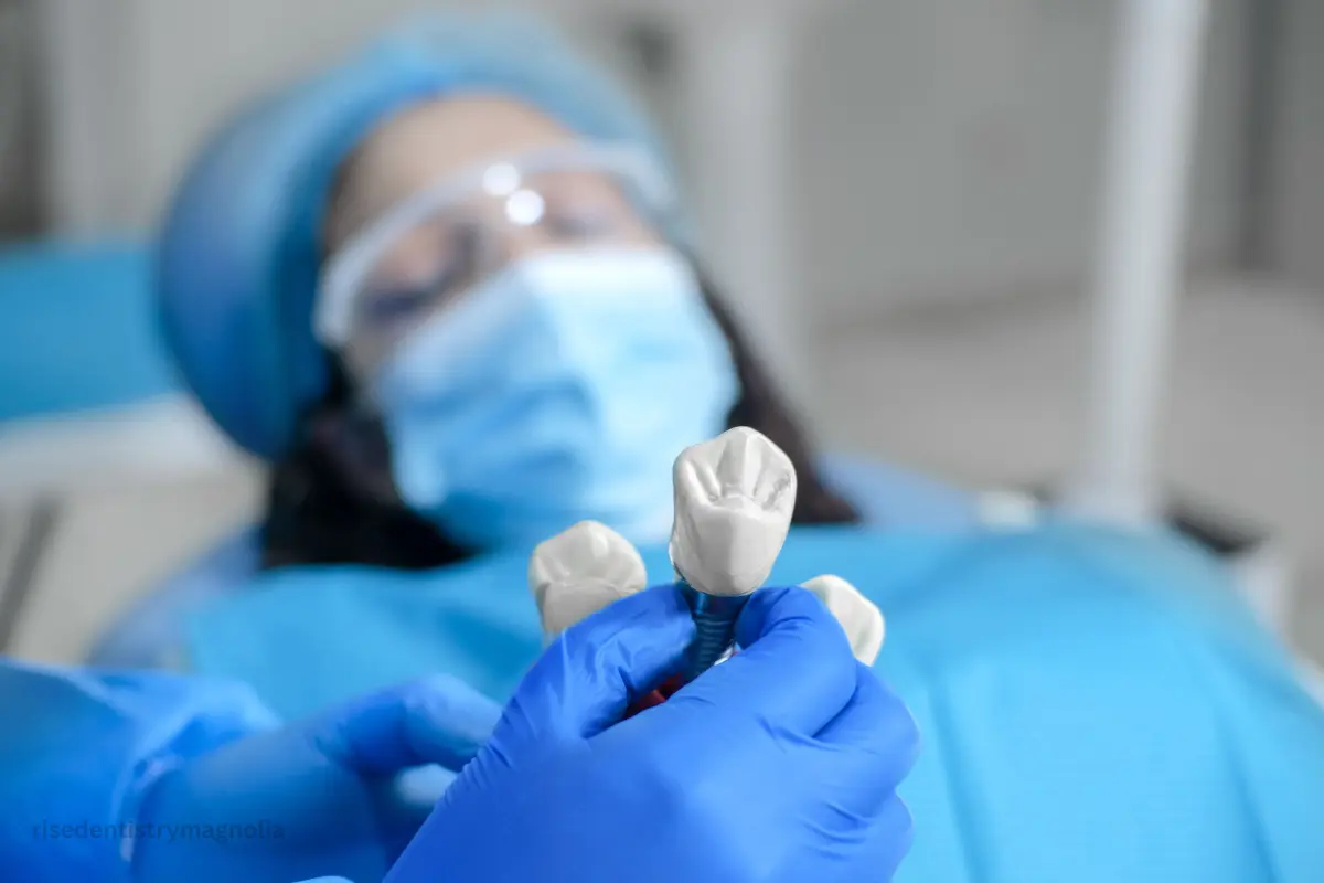 implant versus root canal