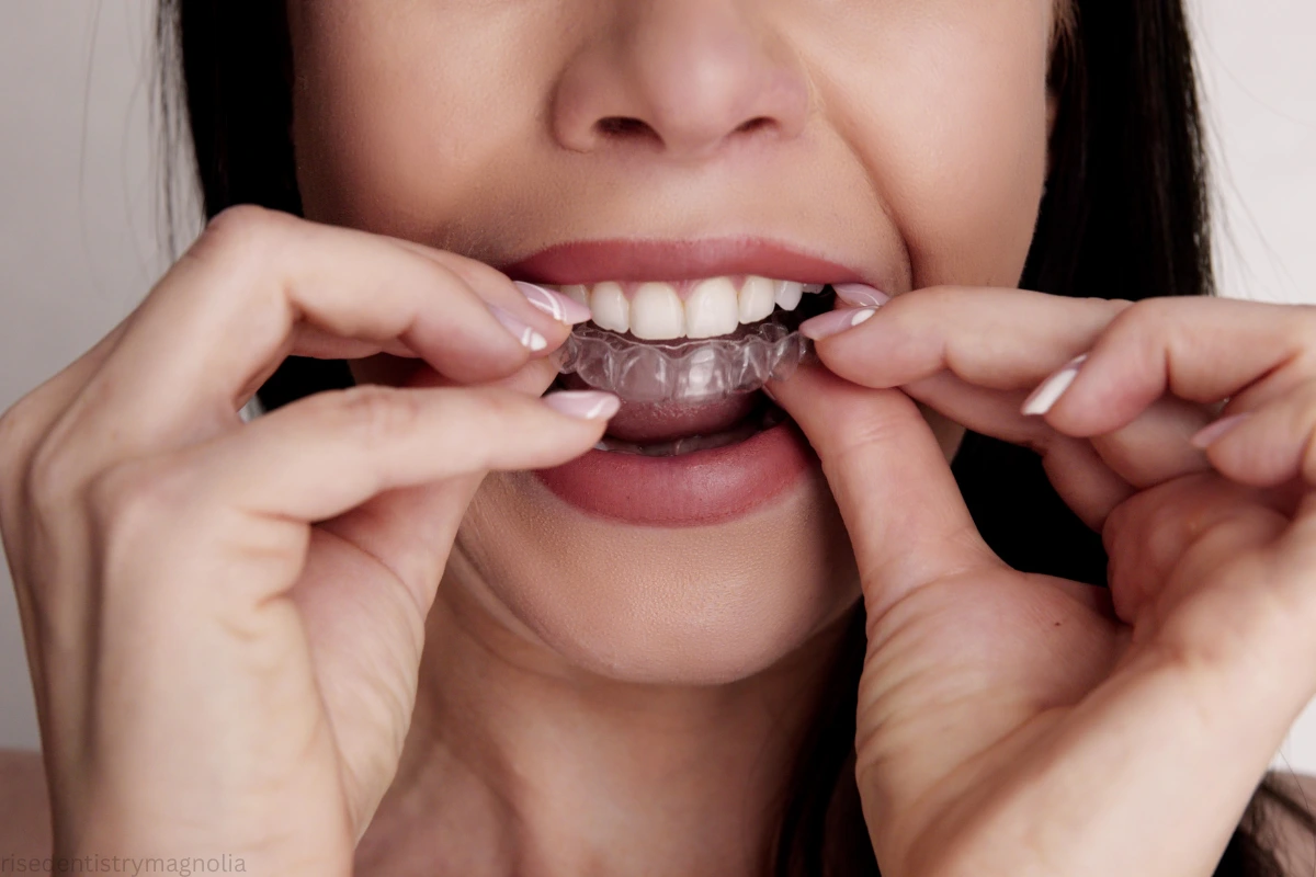 maintenance after teeth straightening