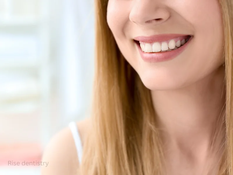 over whitened teeth