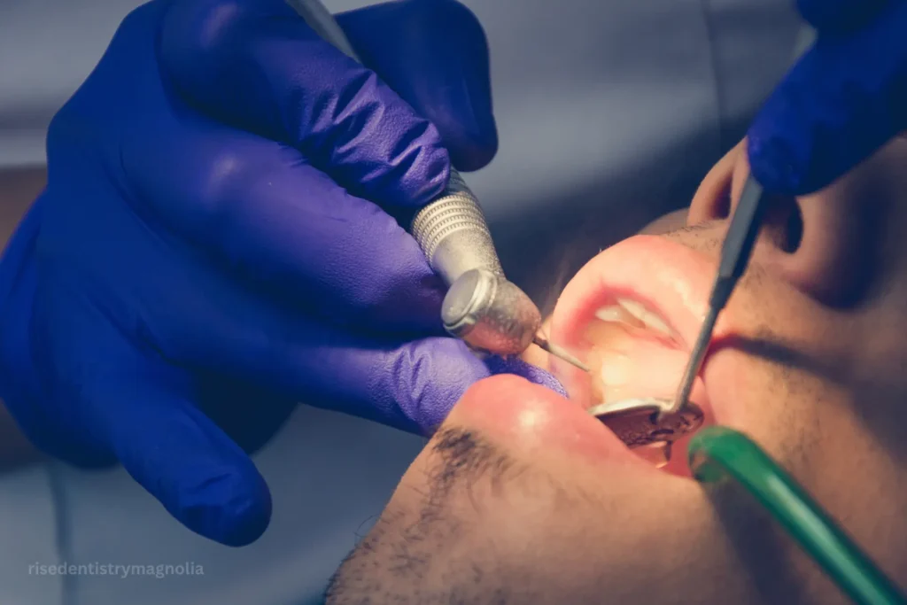 root canal vs implant