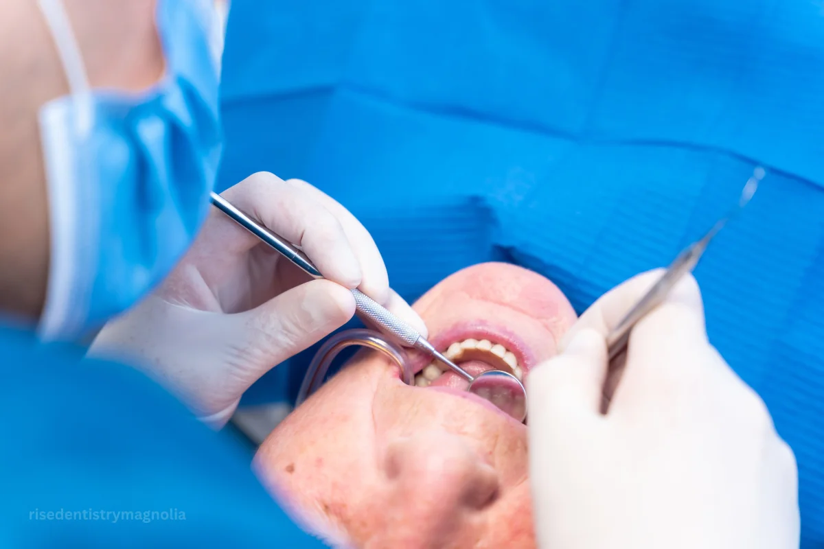 signs you need a root canal vs filling