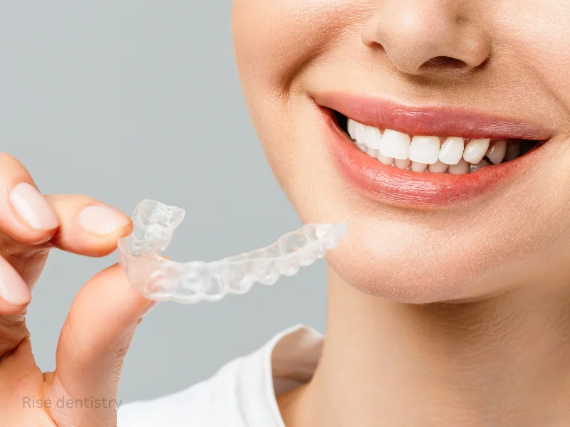 teeth bleaching safe