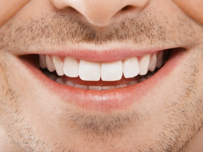 teeth hurt after whitening