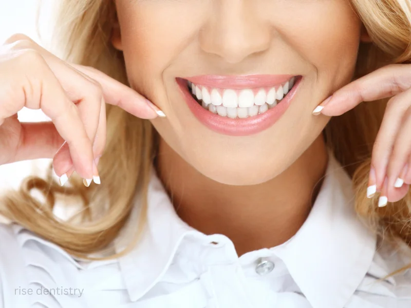 teeth whitening eating afterwards