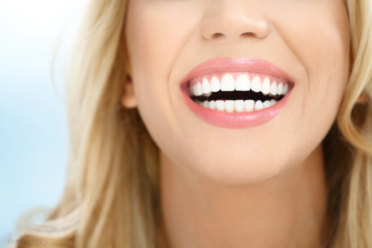 teeth whitening rate