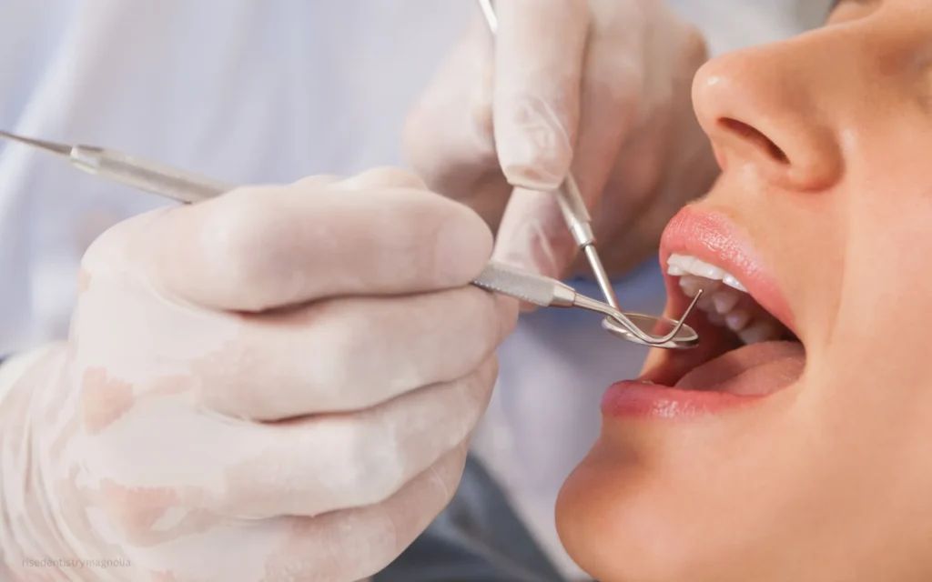 can i brush my teeth after wisdom teeth removal