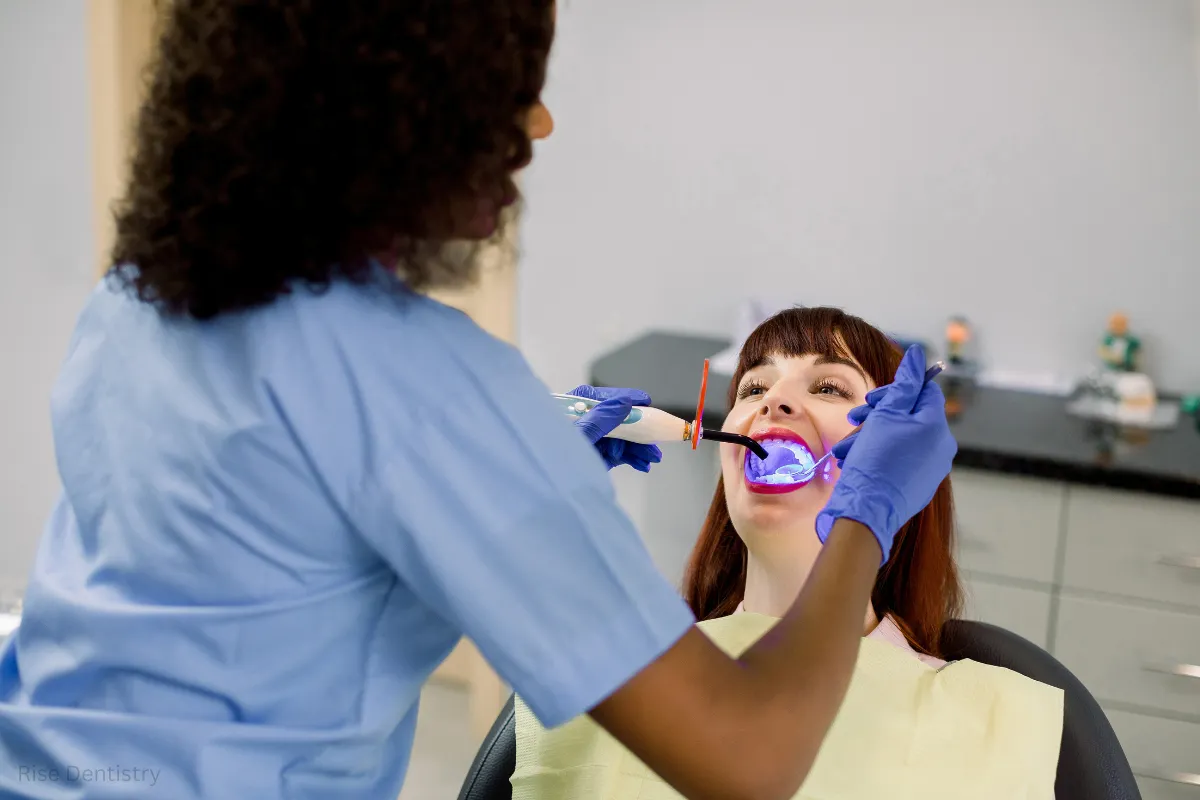 composite bonding time