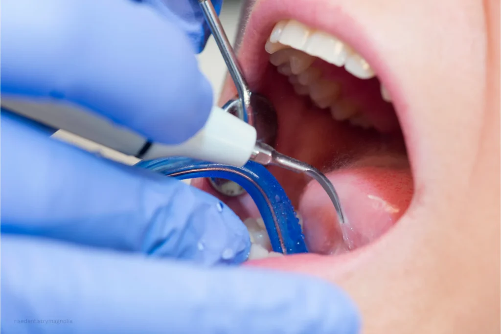 foods to eat after wisdom teeth removal