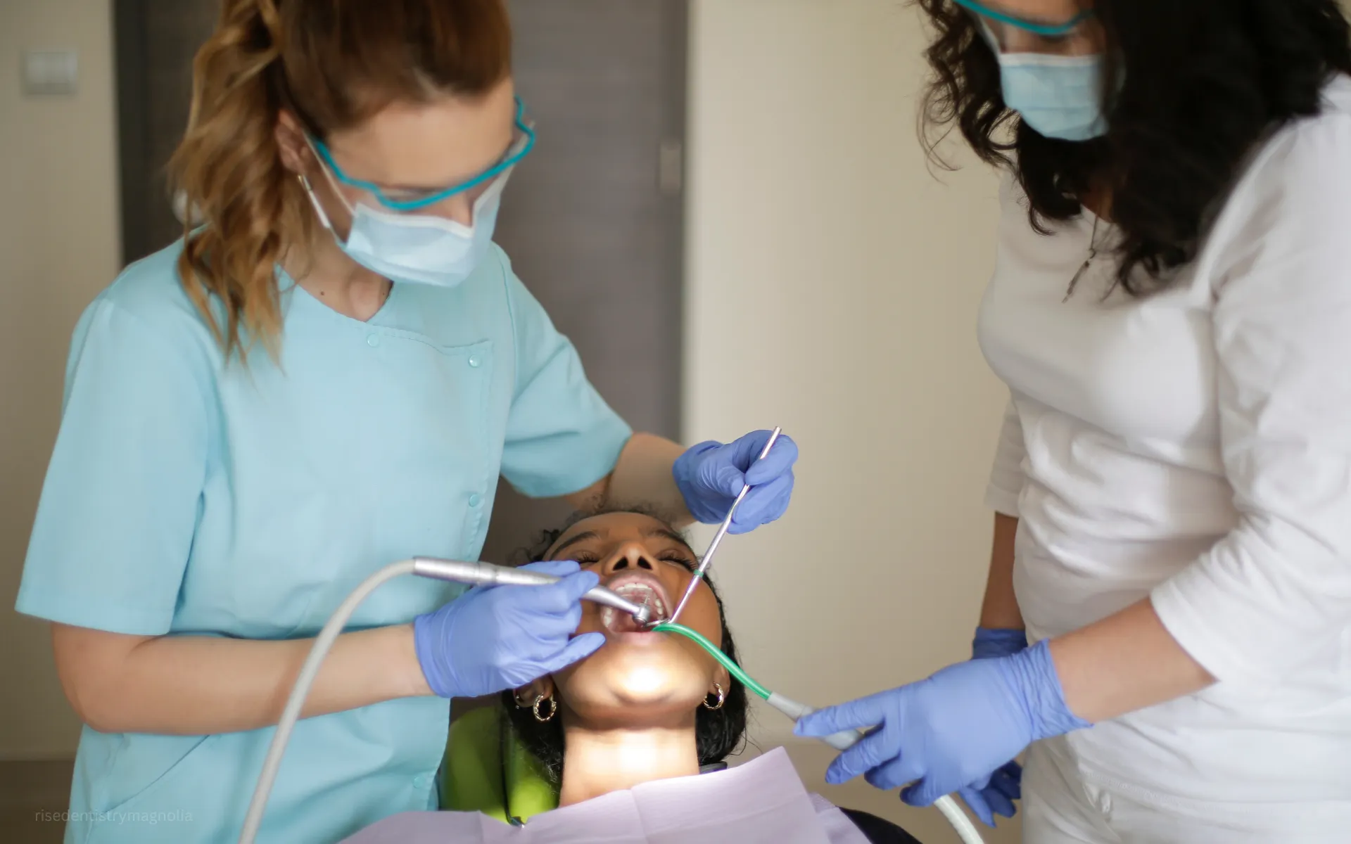 how do i know if i need a root canal