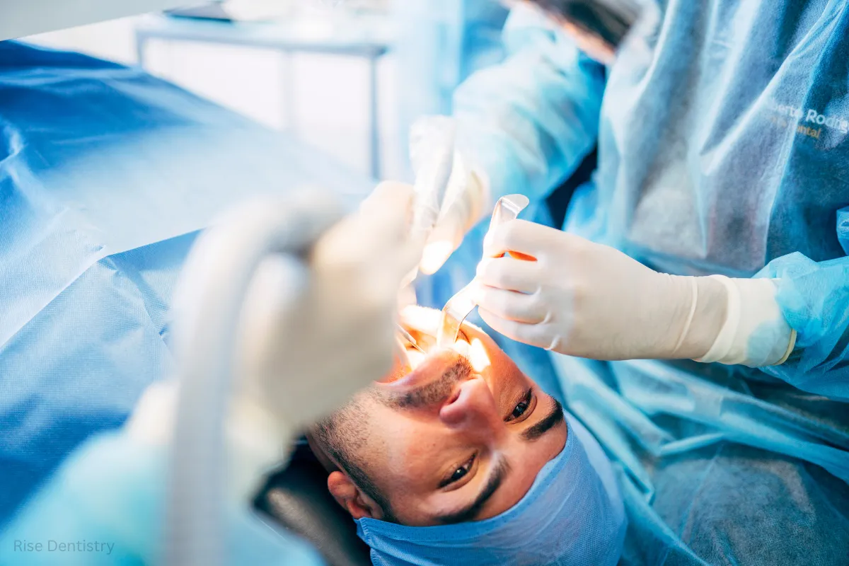 pulpotomy vs root canal cost