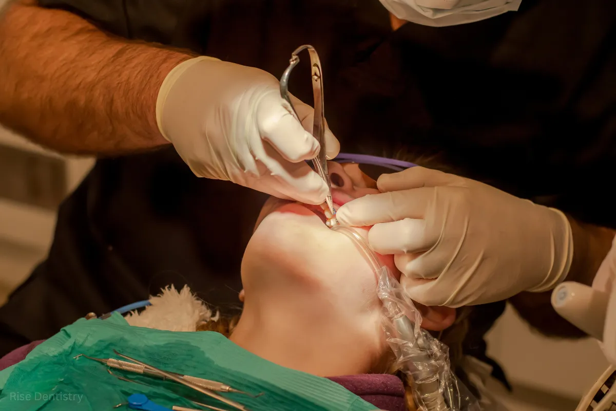 tooth extraction risks and complications