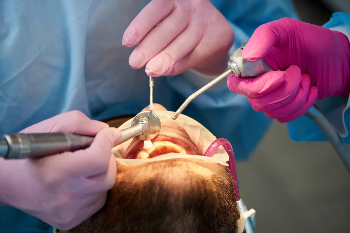 understanding the dental bonding procedure