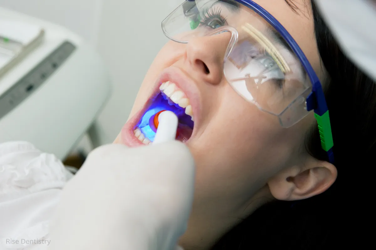 additional costs for dental bridge procedure