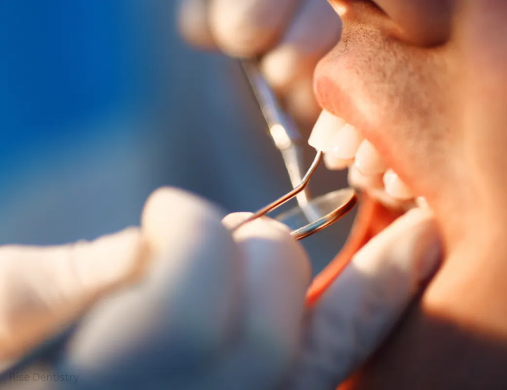 dental crowns prices