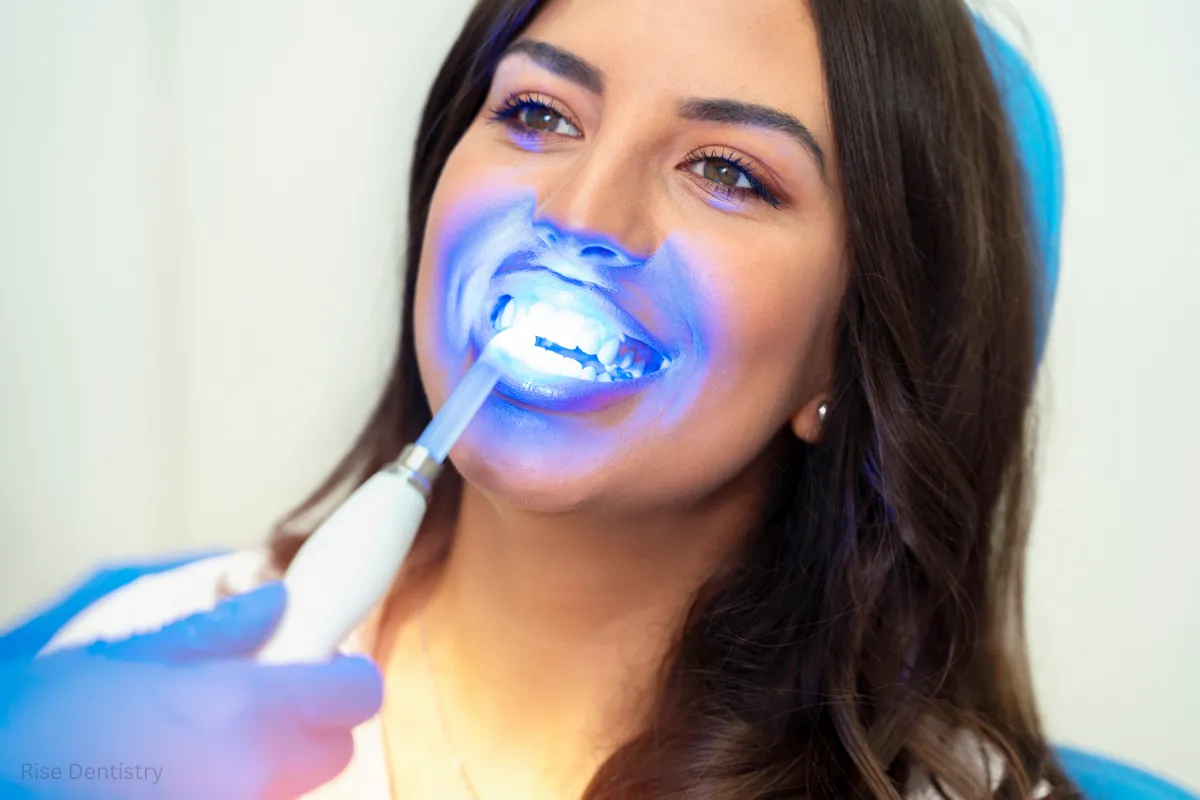 different types of teeth whitening