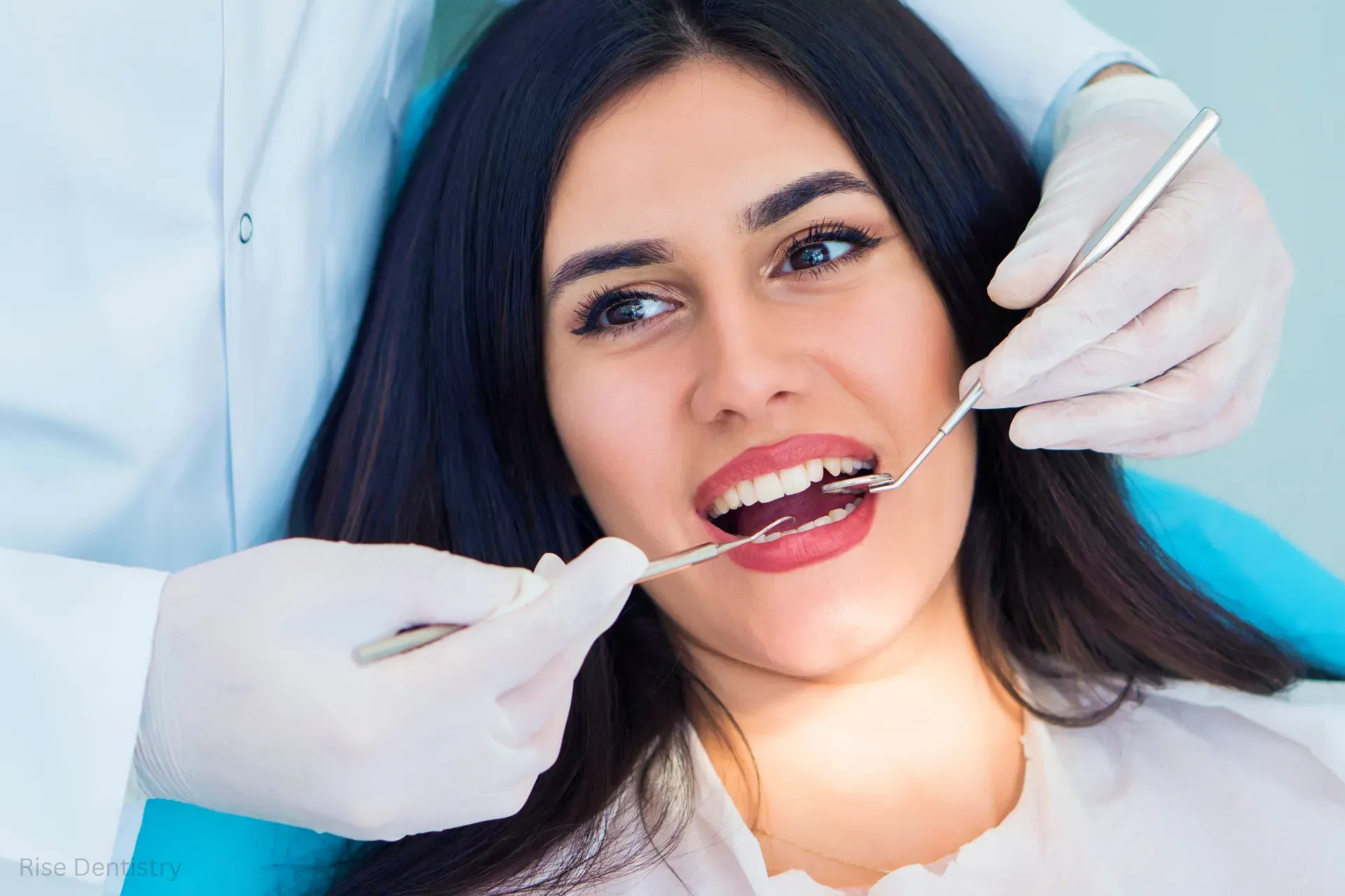 how long does a dental bridge last