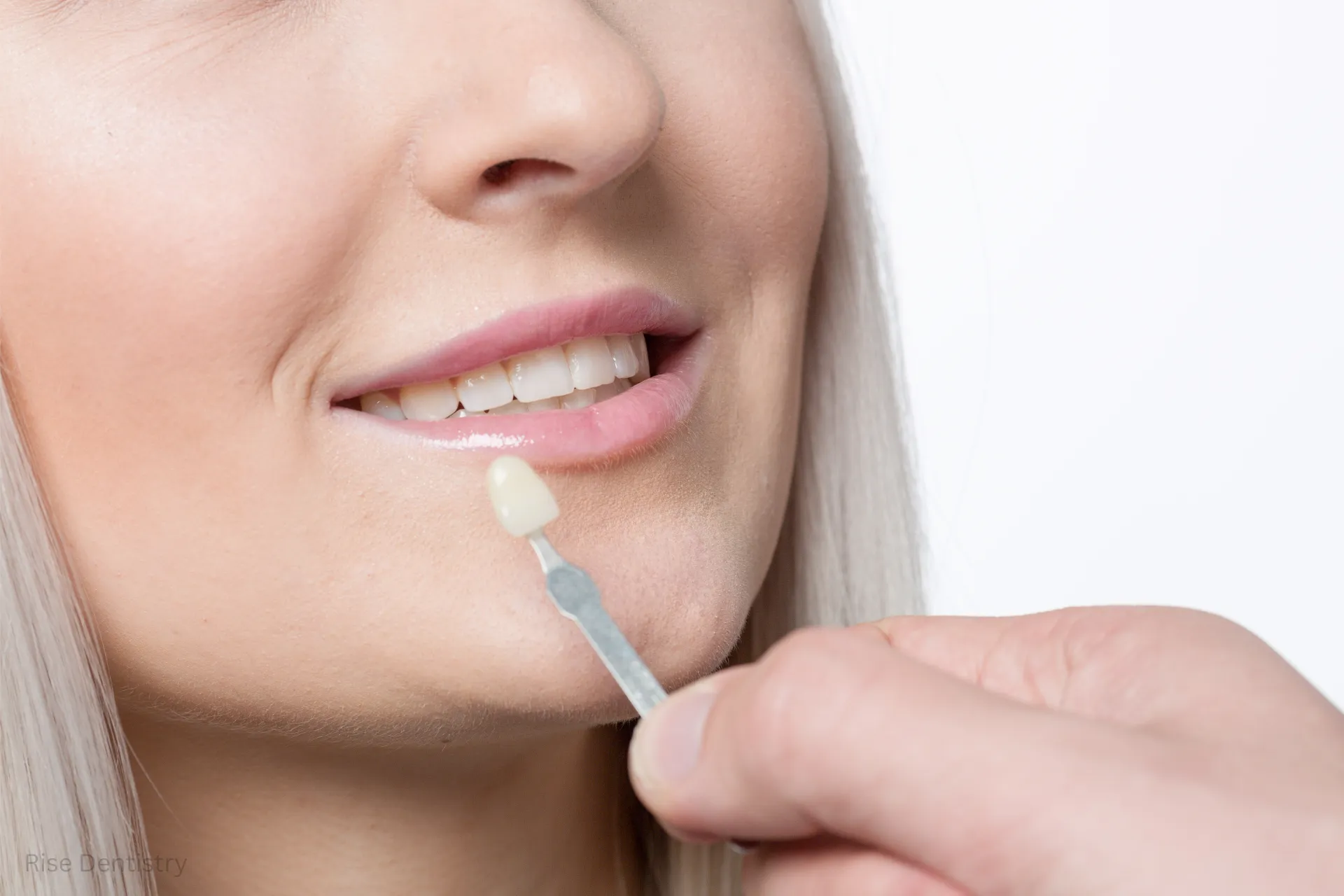 how long does a tooth crown last​