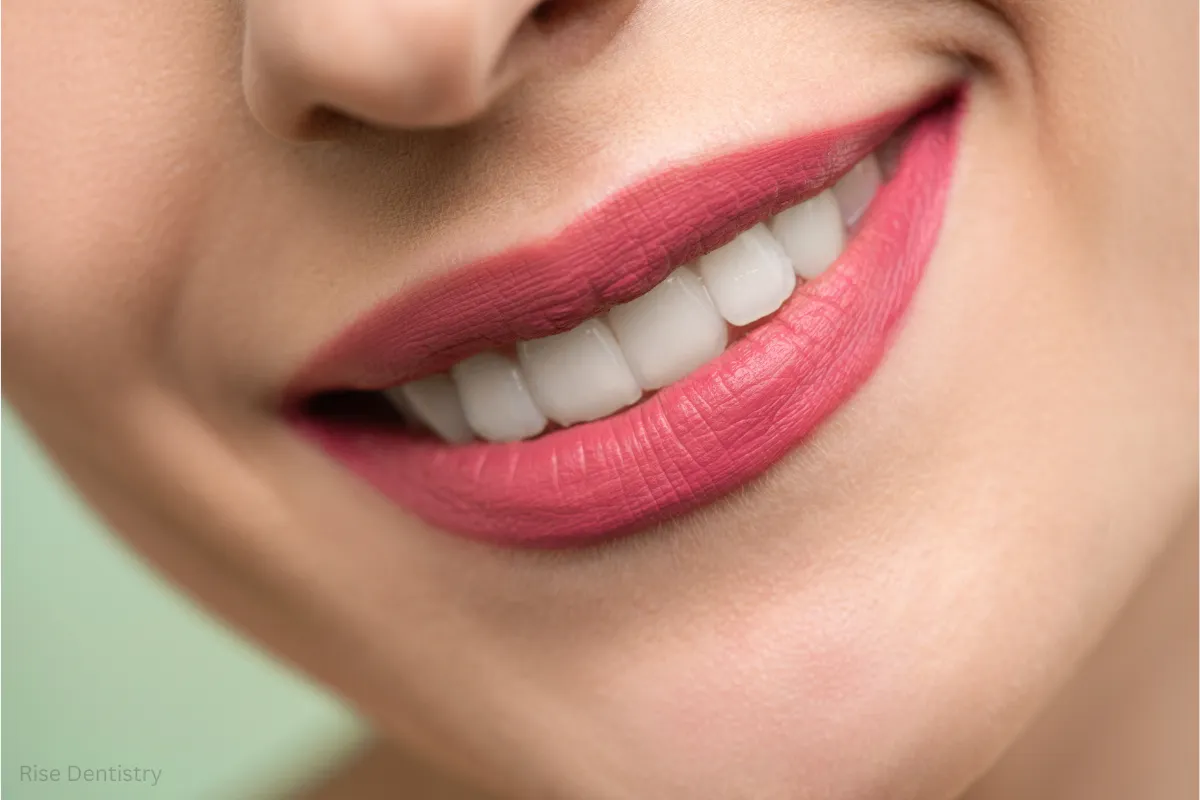professional teeth whitening results