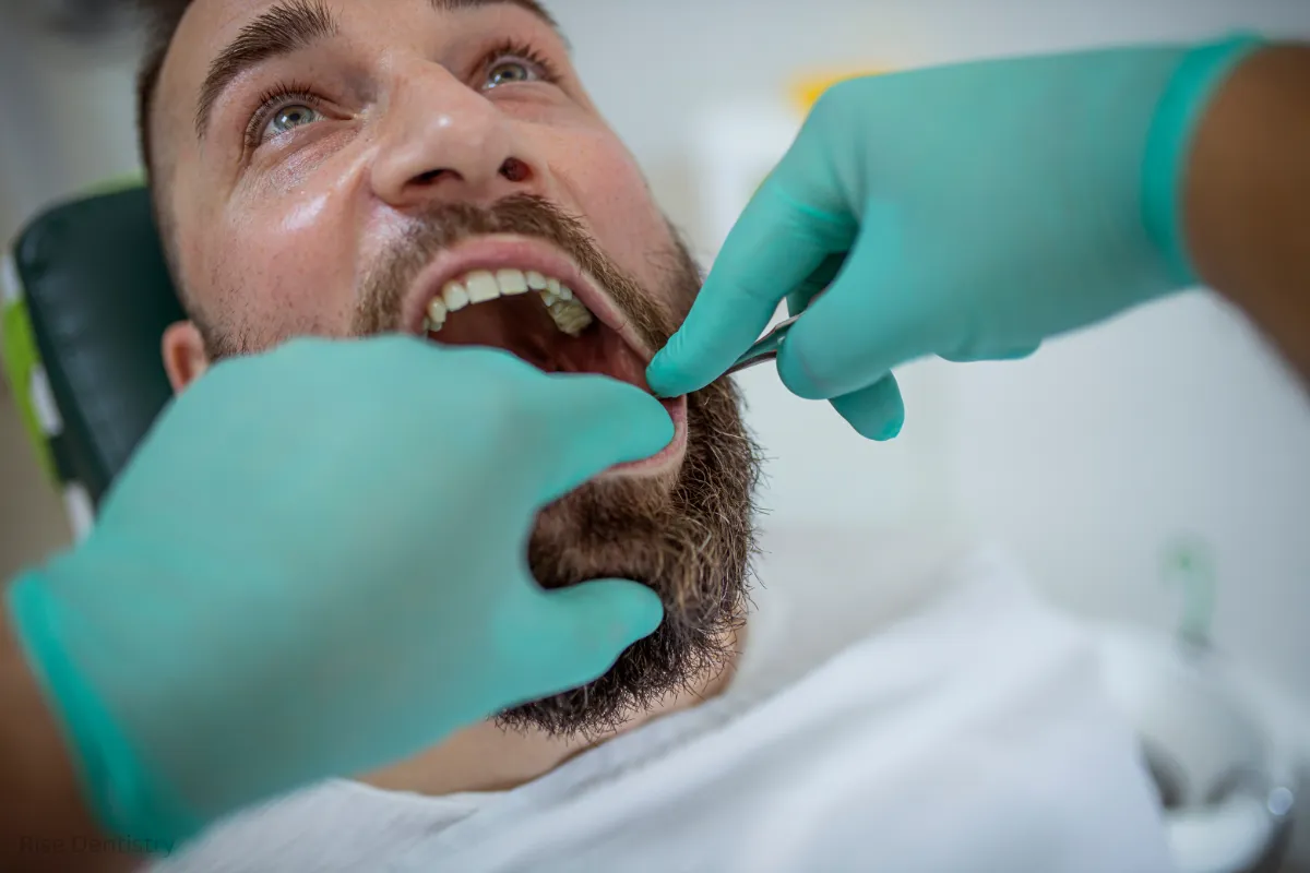 swelling happens after a tooth extraction