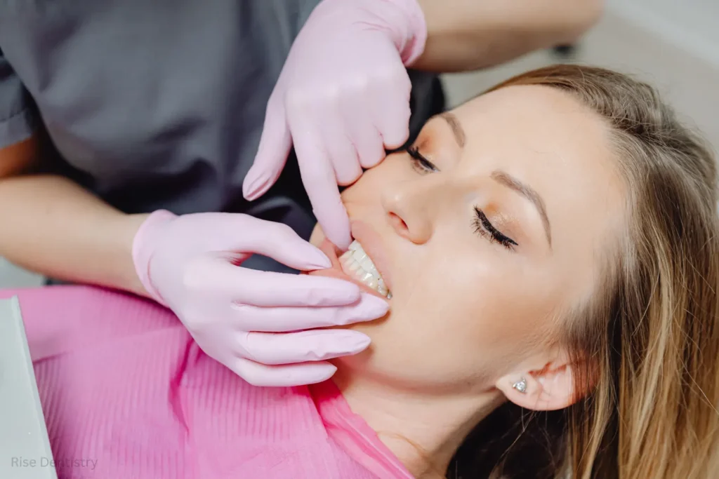 what to eat after teeth whitening