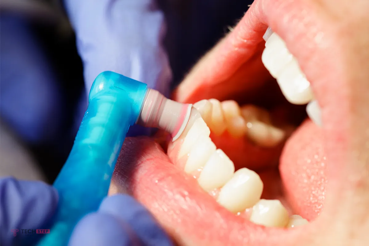 recommended frequency for dental cleanings