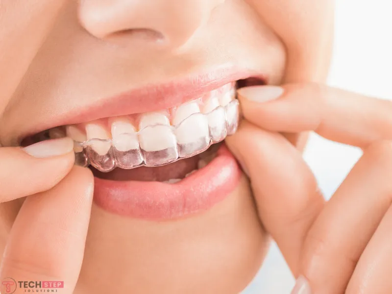 ideal candidates for clear aligners