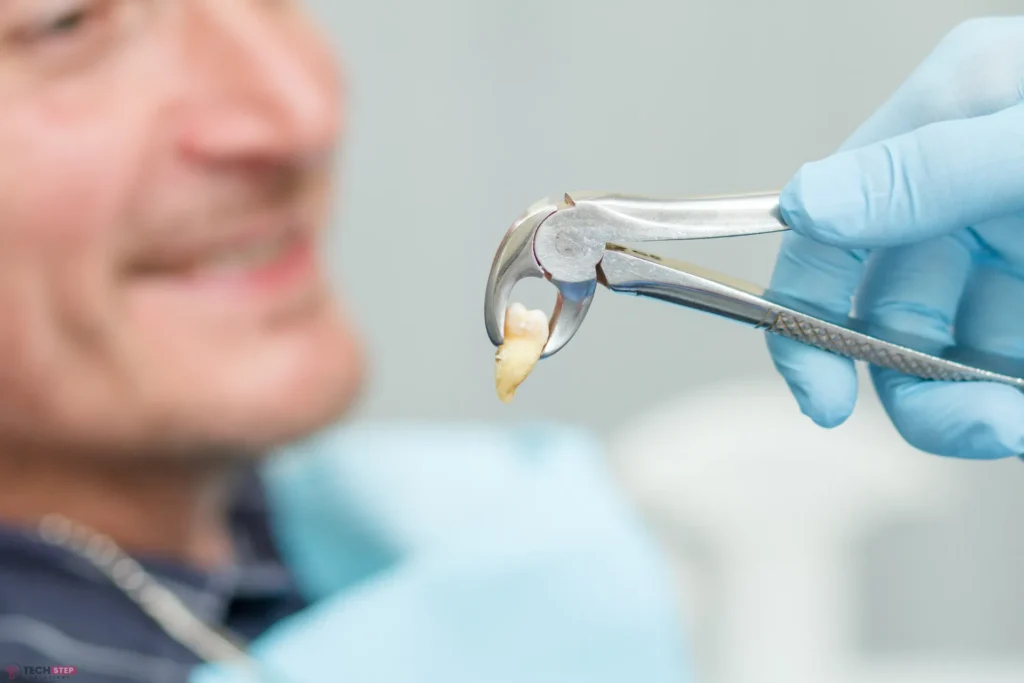 first night after tooth extraction