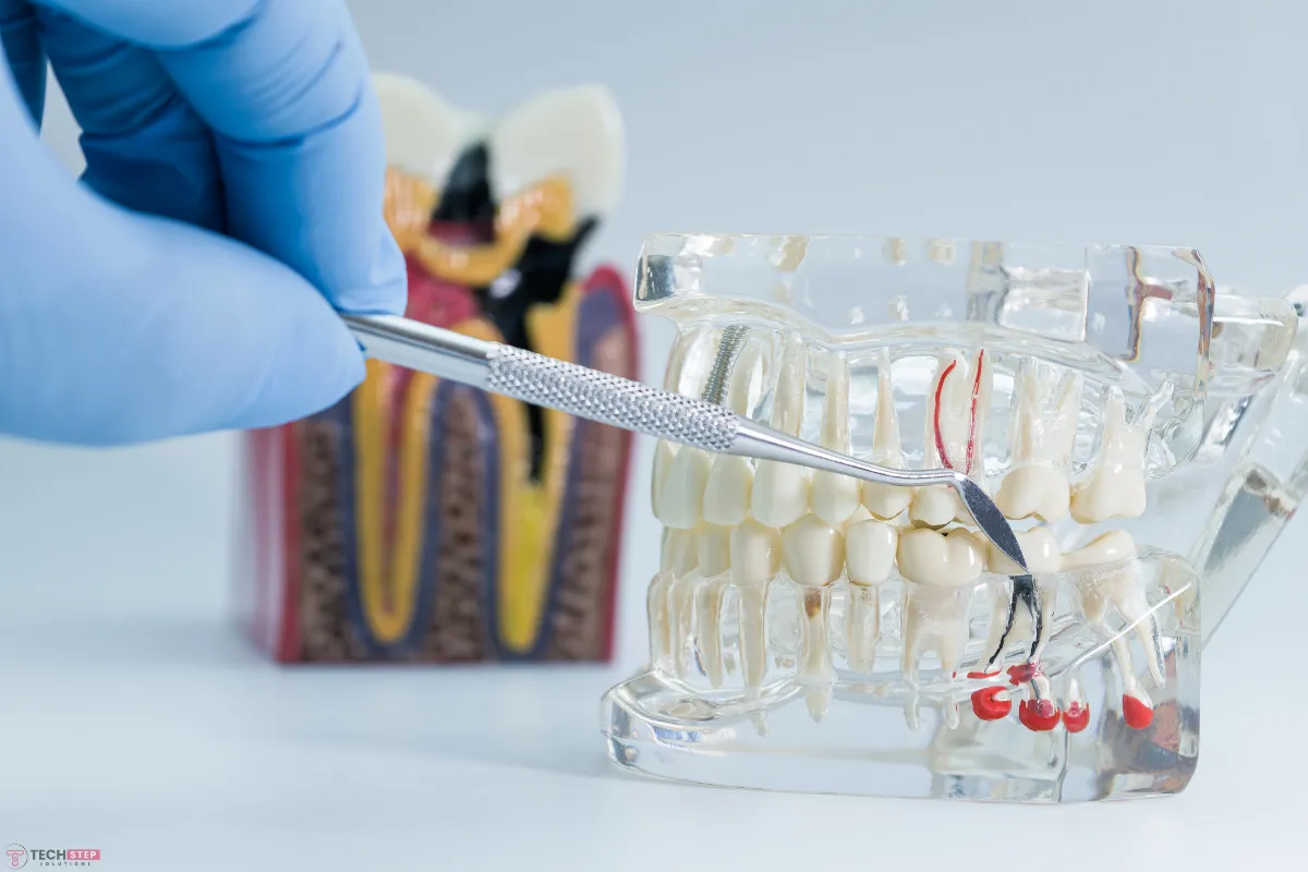 tooth pain before a root canal