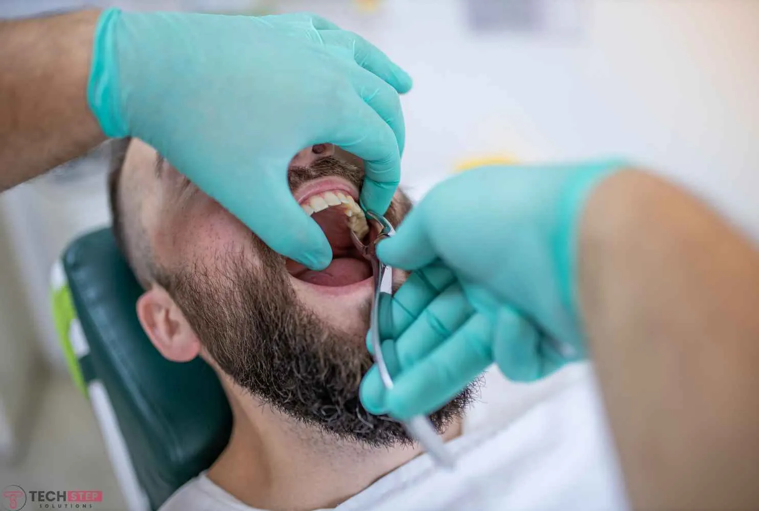 wisdom tooth extraction