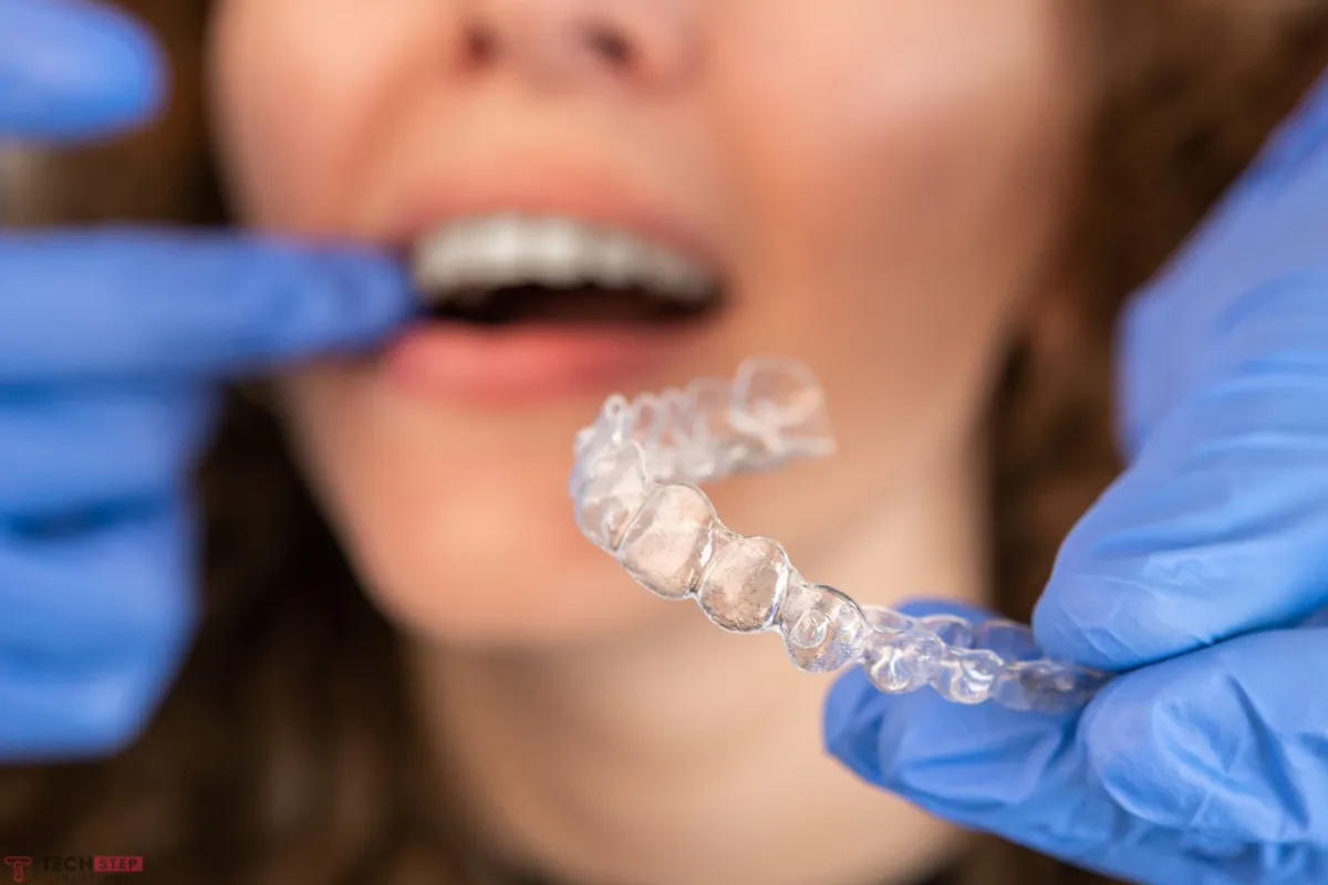 clear aligners services