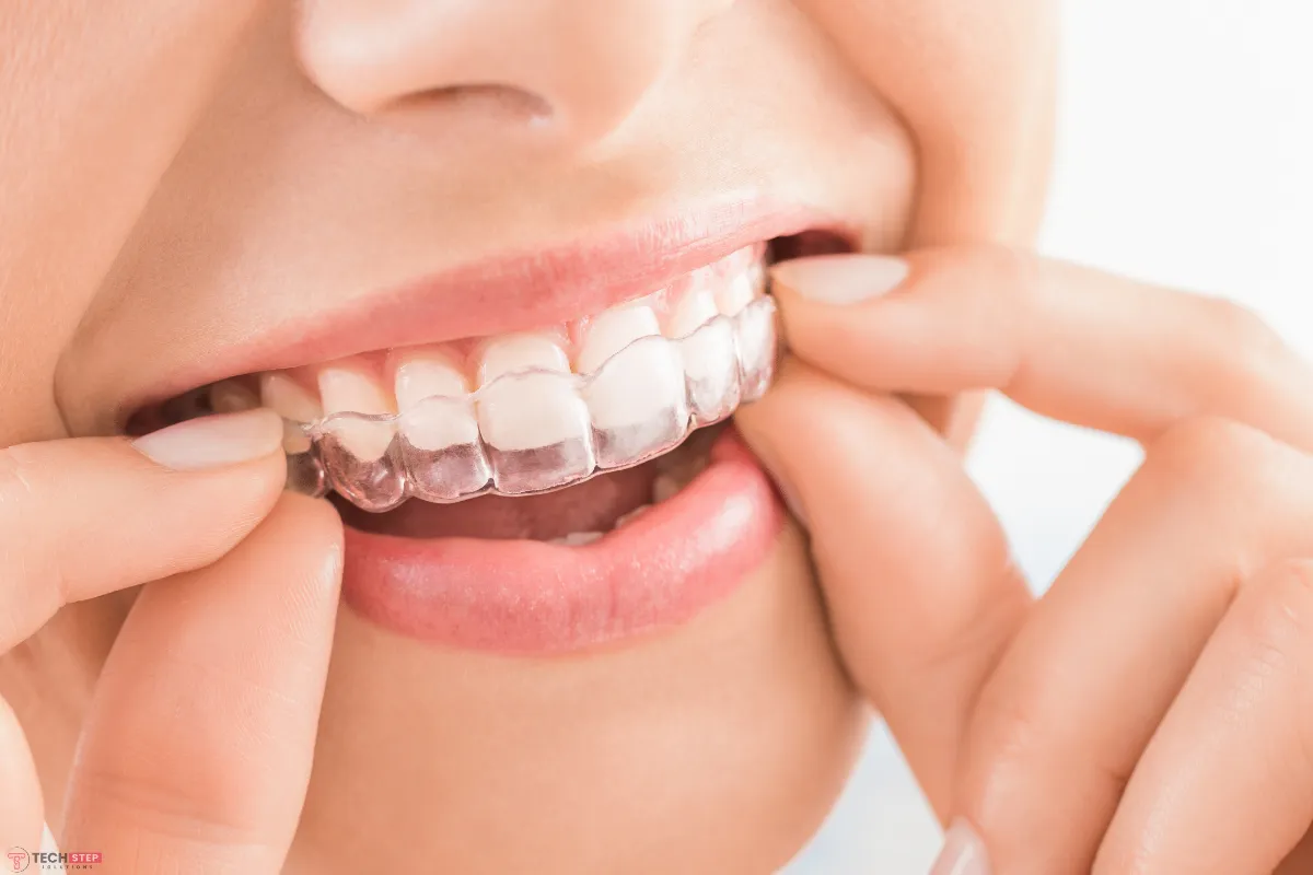 epert insights into cosmetic dentistry treatment