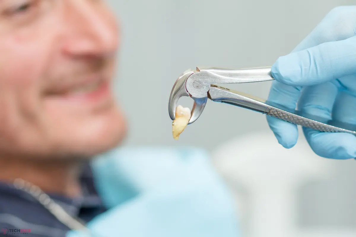 emergency tooth extraction