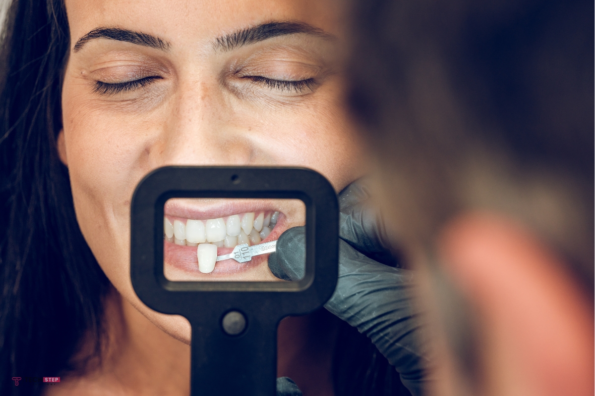 Porcelain Veneers Cost